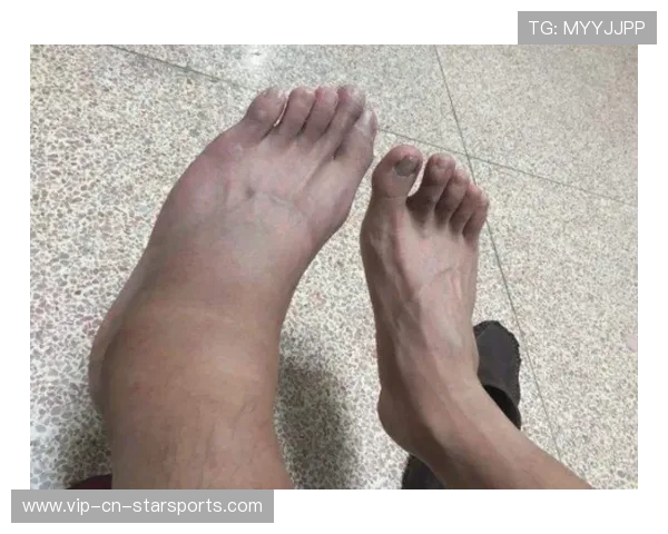 世界冠军腿部严重拉伤
